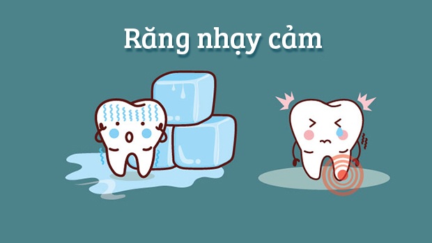 rang-nhay-cam