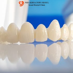 Khi nào nên bọc mão răng Zirconia