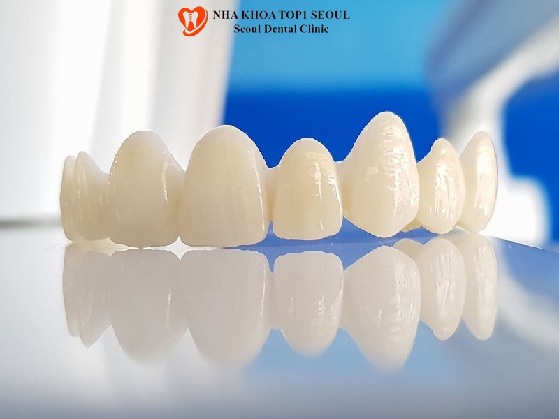 Khi nào nên bọc mão răng Zirconia