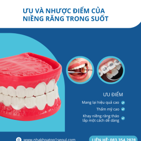 ưu điểm của niêng răng trong suốt