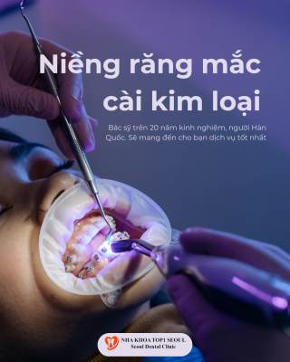 niềng răng mắc cài kim loại là gì